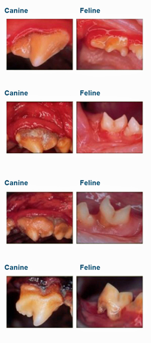Stages of Periodontal Disease